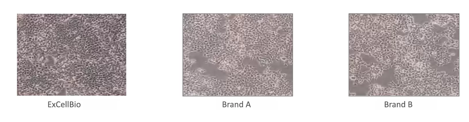 What Is Biochemical Serum Screening and How It Applies to Serum Lots Used in Cell Culture Media